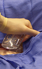 effective hemostasis